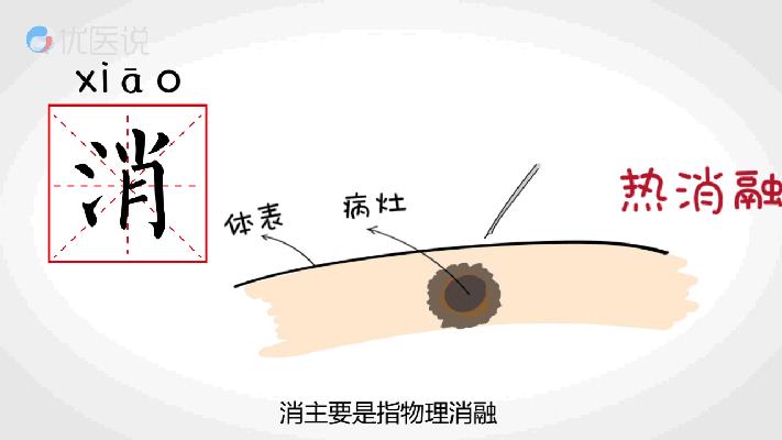 肿瘤治疗的“新*器武**”——介入治疗