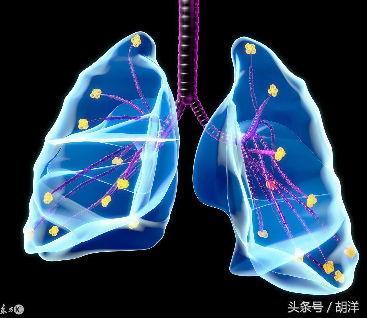 肺炎所致的感染性休克应观察什么,肺炎一定会出现的症状