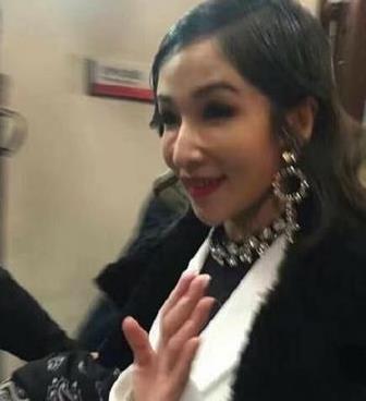 香港最老明星整容失败照片对比,整容失败的明星有哪些