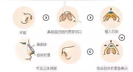 热巴赵丽颖合照,热巴与赵丽颖同框