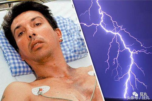 被闪电击中的人会怎么样,被闪电击中得到永生