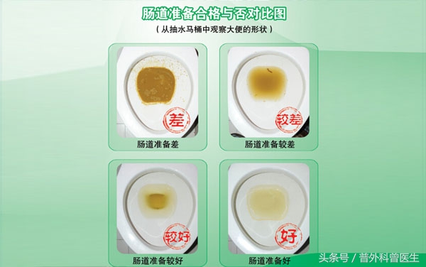 胃肠镜做完后饮食方面应注意什么,做了肠镜息肉后饮食注意吃些什么