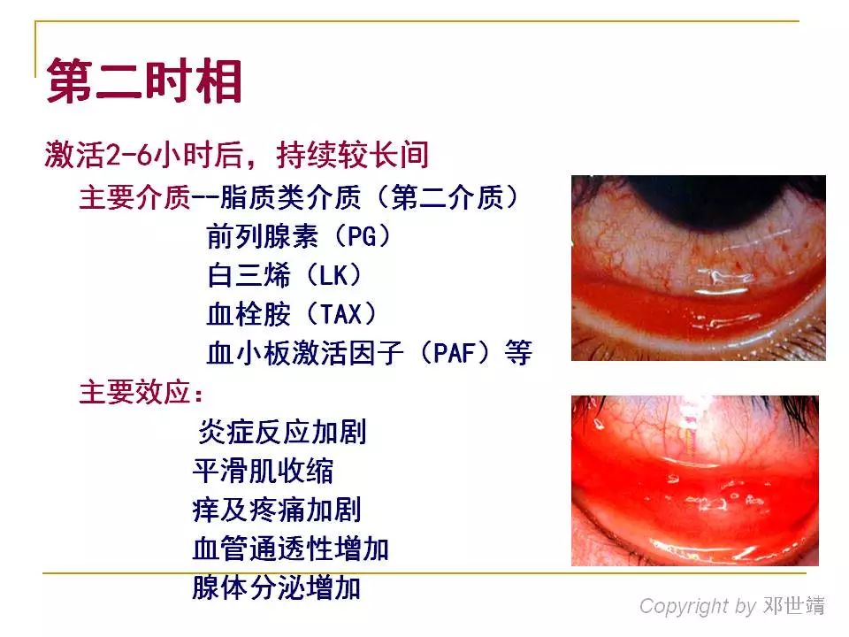 眼周过敏中医治疗,眼周过敏的症状图片