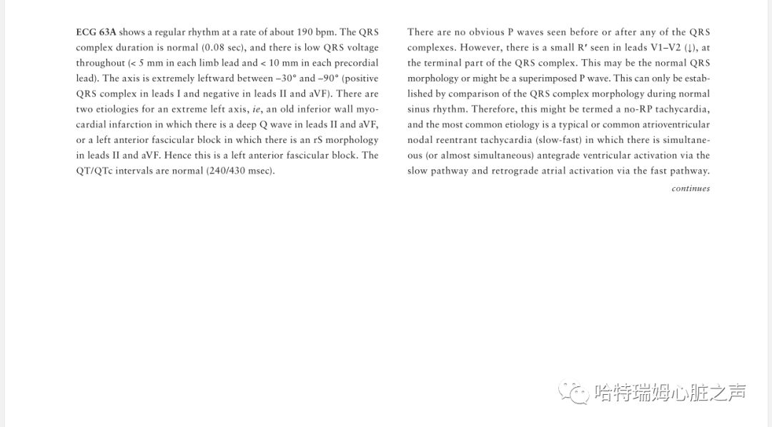 「读心有术」329期:电轴极度左偏,病因有两种