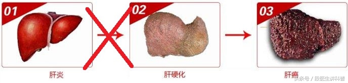 急性肝炎不治会造成什么样的后果,有肝炎如果不治理还能活多久