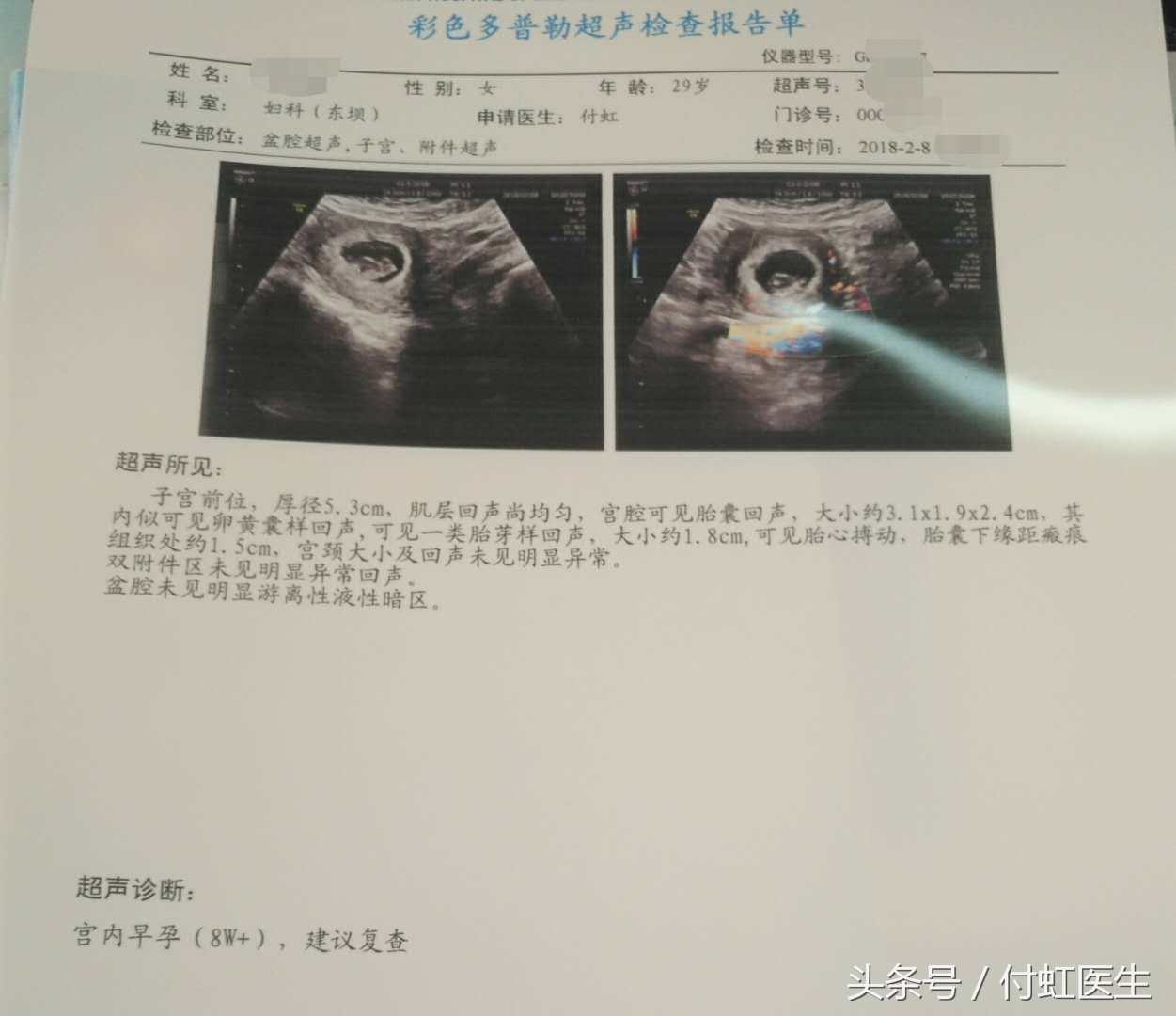 早流产吃什么药,早早孕保胎吃什么好