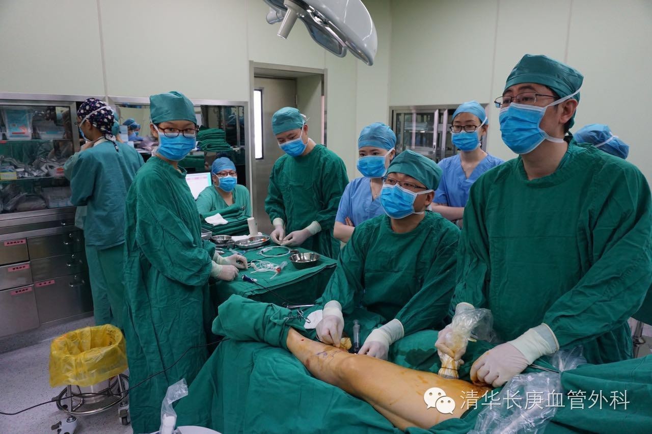 北京医院静脉曲张微创手术,清华长庚静脉曲张