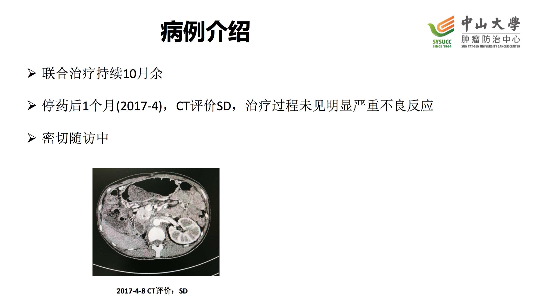 阿昔替尼联合单抗效果好吗,阿昔替尼联合免疫治疗肾癌