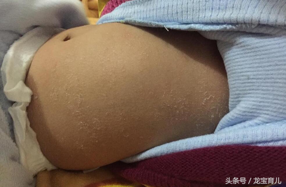 宝宝出生后第一周体重增长标准,宝宝出生第一个星期体重下降多少