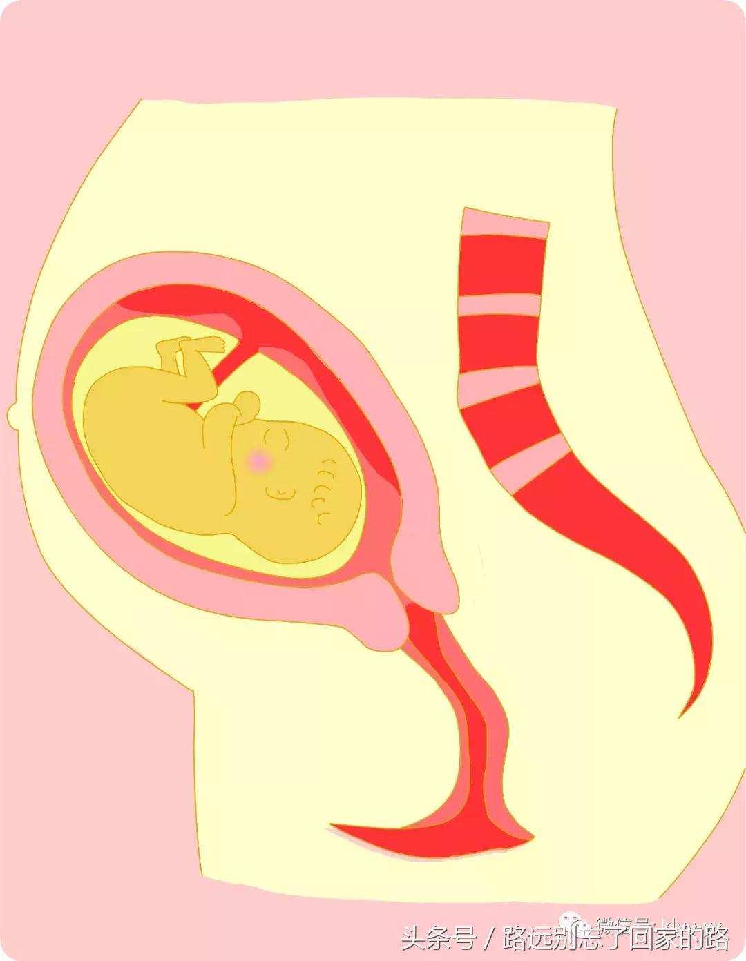 产科医生一般不会告诉你，这5种情况他们可能会考虑采取剖宫产！