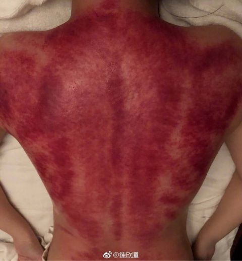 阿娇凌晨发裸背照，网友：我的内心毫无波动，甚至有点恶心