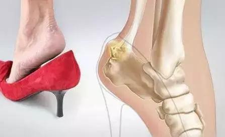 皮鞋后脚跟上沿太硬磨脚怎么办,皮鞋大了会磨脚还是小了会磨脚