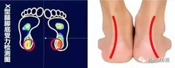 如何挑选一双最适合自己的跑鞋,如何选适合自己的跑鞋