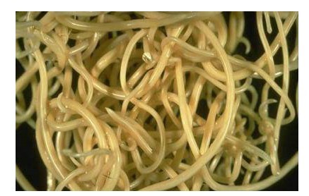 儿童寄生虫病怎么治疗效果好,儿童寄生虫怎么消灭最快