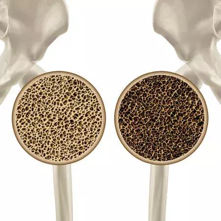 吃辣的喝牛奶才不会长痘,吃辣喝牛奶长痘吗