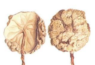 生完孩子后胎盘可以吃吗,生了孩子后胎盘可以吃吗