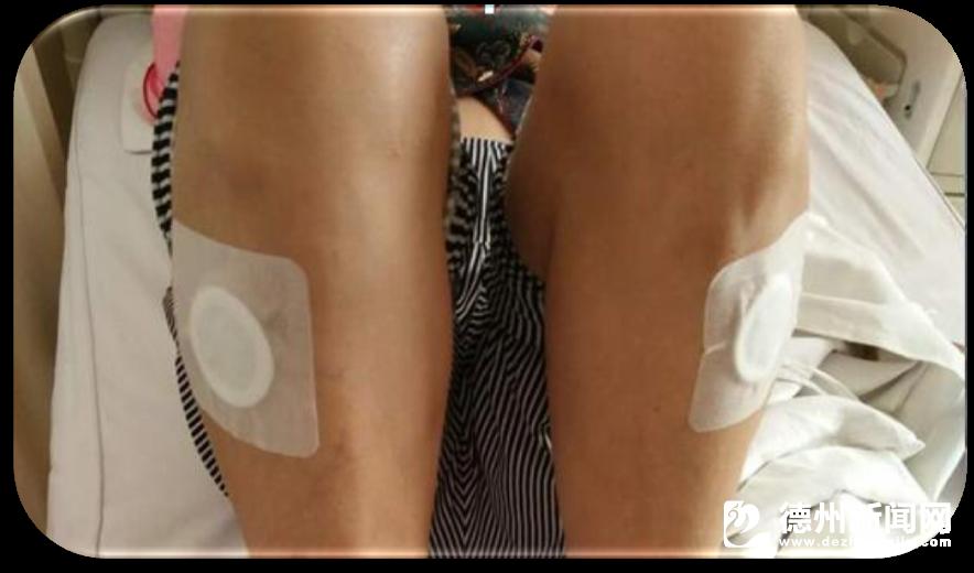 寰峰窞鑱斿悎鍖婚櫌鍐呯鍖荤敓椹壃,寰峰窞鑱斿悎鍖婚櫌棰勭害鎸傚彿