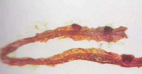 鸡病判断法,鸡的常见疾病及临床表现