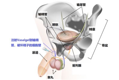 男性口服避孕药推荐,男性有口服避孕药吗
