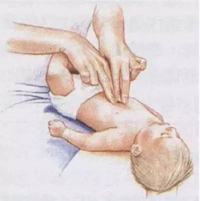 噎到了急救方法叫什么,噎到了急救方法自救