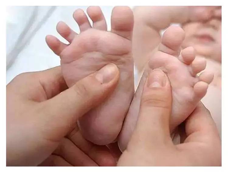 十天宝宝自己怎么判断黄疸,宝宝黄疸护理方法