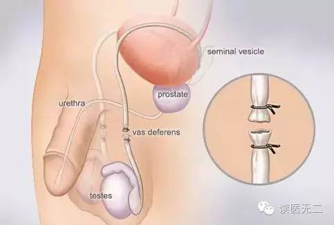 第四代避孕药怎么样,第4代避孕药有哪些