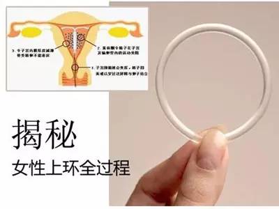 女性上环对血压有影响吗,女性上环前需要注意什么