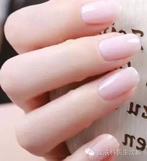 以为是灰指甲结果指甲掉了,得了灰指甲不管它行吗