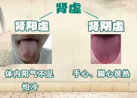 后背发冷是肾阳虚还是脾阳虚,男生说后背发凉怎么回