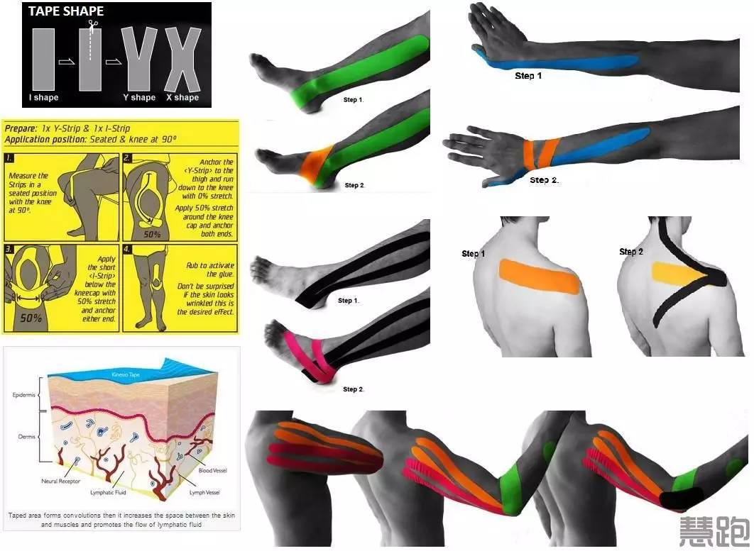 肌贴怎么打有利于跑步的发力,跑马肌贴教学