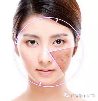 激素依赖性皮炎怎么治疗能彻底,激素依赖性皮炎最好的治疗方法