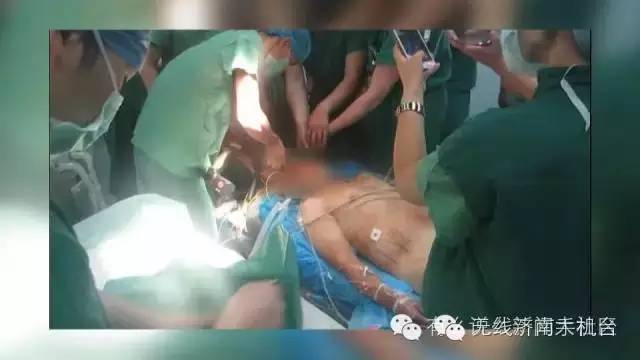 济南男子被1米长钢筋从阴部穿到脑部30名专家开颅开胸开腹手术7小时保住命