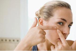 男生祛痘护肤品,祛痘方法男生