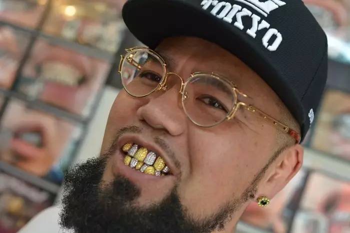 关于最近超火的金牙,你要知道这4件事(起码要知道怎么戴上去吧)