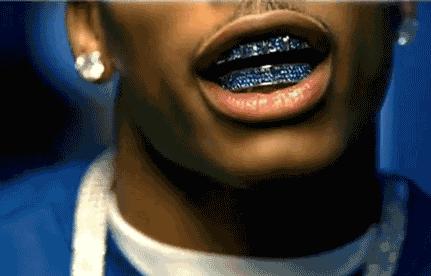 关于最近超火的金牙,你要知道这4件事(起码要知道怎么戴上去吧)