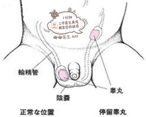 摸不到宝宝吓坏了,如何检测宝宝有没有睾丸