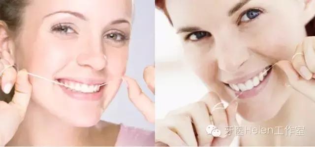 牙医亲自示范牙线使用,牙医建议使用水牙线吗