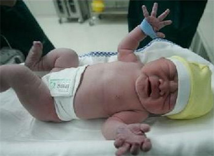 囧！生孩子时大便都出来了，姐妹们有过这样经验吗？