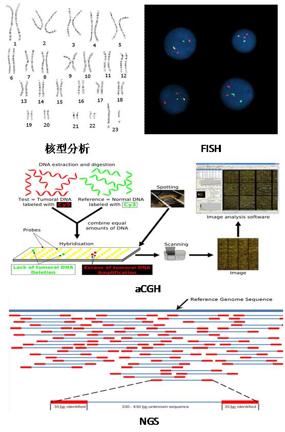 染色体异常检测在流产原因排查中的应用