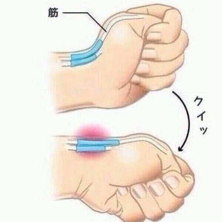 玩手机时右手大拇指酸和无力,手机不离手手指疼