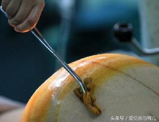 剖腹产取环有困难不,剖腹产的妇女摘环难吗