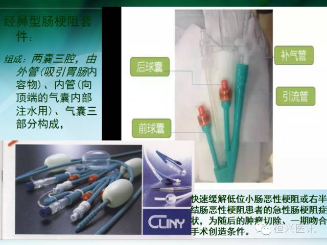 北京协和医院治疗肠梗阻的专家,恶性肠梗阻专家