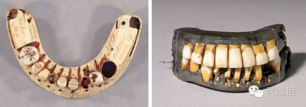 虎口拔牙之后的故事,拔牙放血的故事