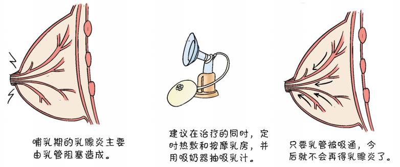 上班妈妈背奶需要每次吸吸奶器么,职场宝妈须知吸奶器的选择与使用