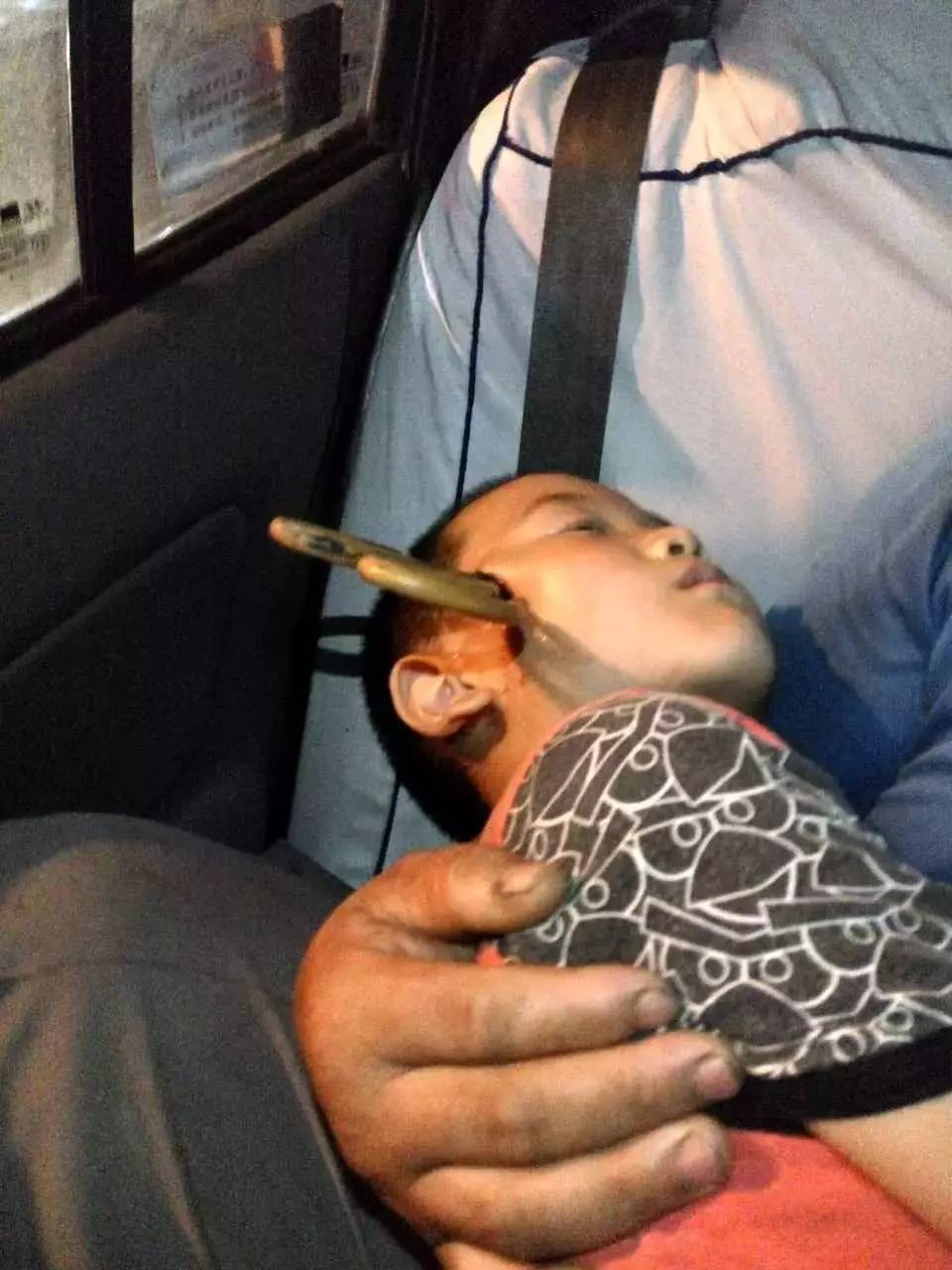 男童被剪刀刺伤致大动脉破裂出血,太阳穴被剪刀刺伤会怎么样