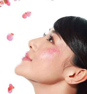 湿疹留下的黑印一般多久消失,湿疹红斑多长时间才能消失