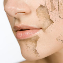 产后脸部皮肤干燥起皮屑怎么办,产后皮肤干燥起皮怎么回事