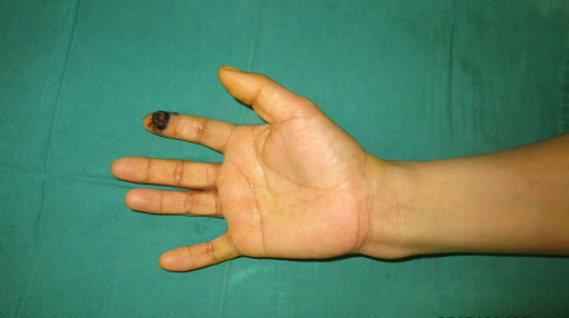 孙红雷谈黑痣长在哪里,孙红雷演的黑痣病变