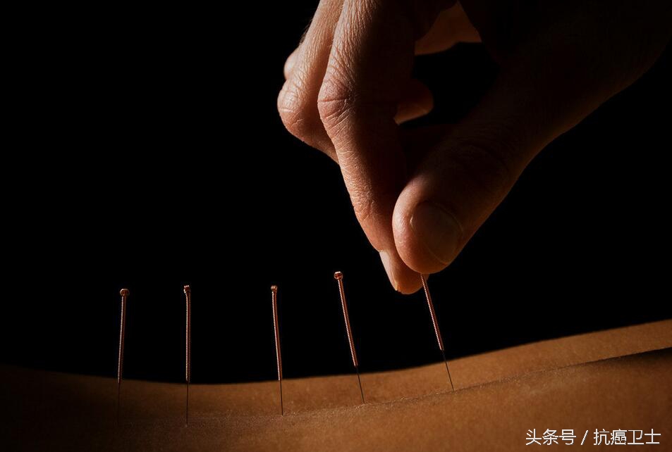 针灸推拿治疗癌症,癌症后期昏迷中医针灸