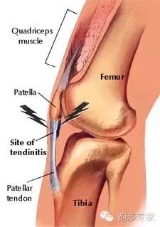 膝盖受伤一般要多久才能恢复,腿膝盖软组织受伤多久会好